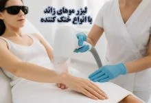 لیزر باخنک کننده