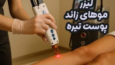 لیزر موهای زائد پوست تیره