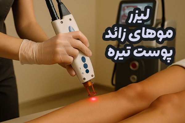 لیزر موهای زائد پوست تیره