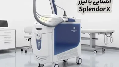لیزر مو Splendor X