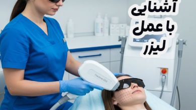 آشنایی با عمل لیزر
