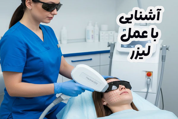 آشنایی با عمل لیزر