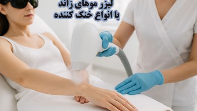 لیزر باخنک کننده