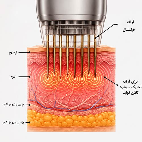فرکشنال