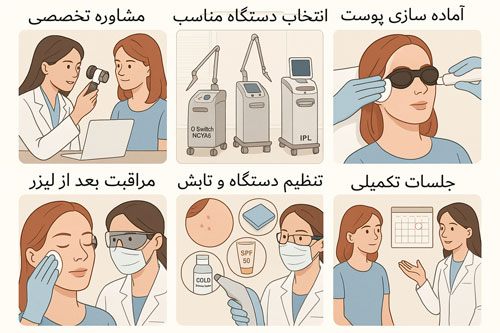 لیزرلک مراحل لیزر لک