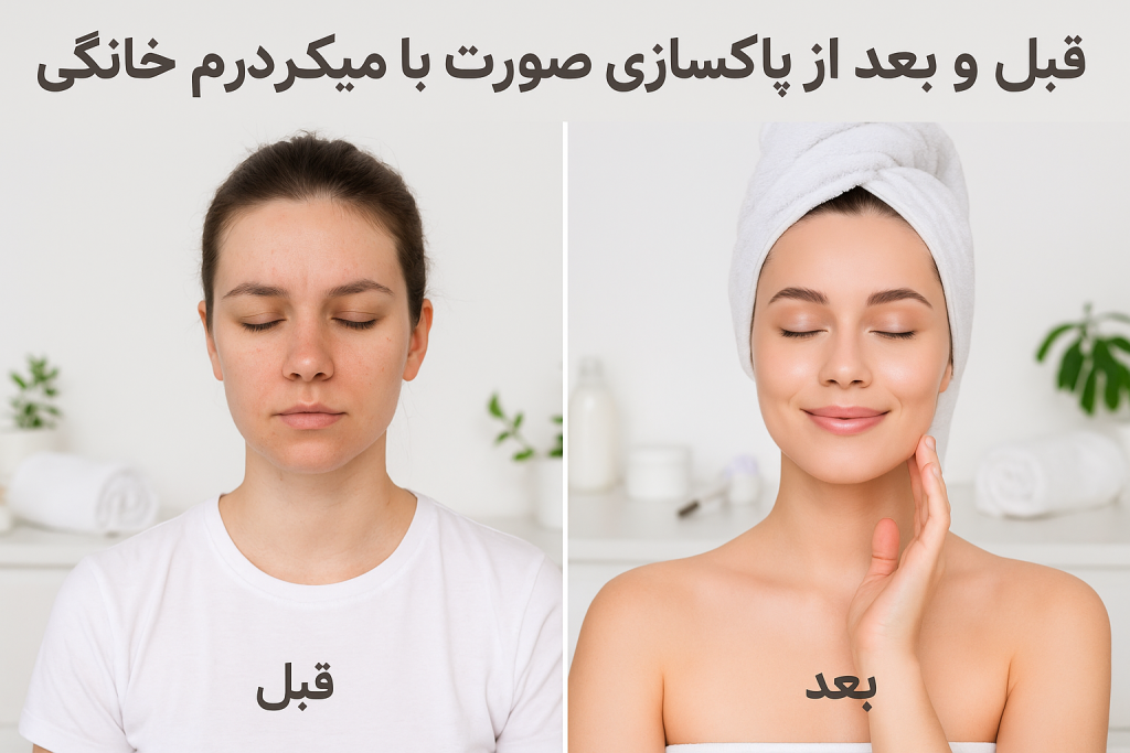 پاکسازی با دستگاه میکرودرم خانگی