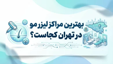 مراکز لیزر مو در تهران
