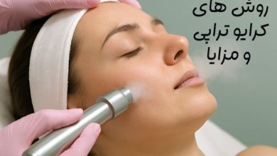 کرایوتراپی موضعی