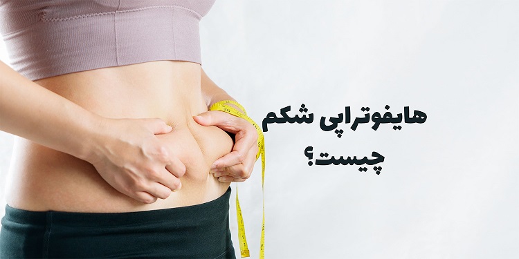 هایفوتراپی شکم