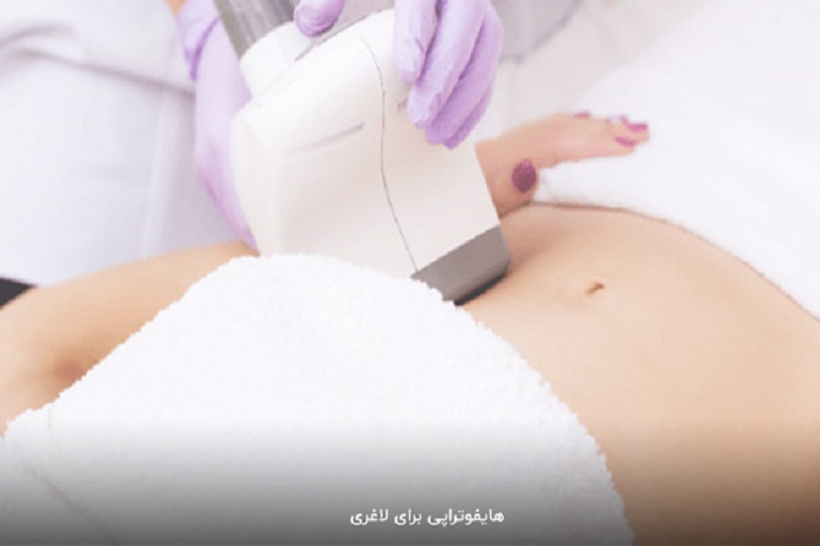 هایفوتراپی شکم