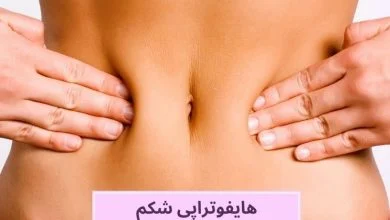 هایفوتراپی شکم
