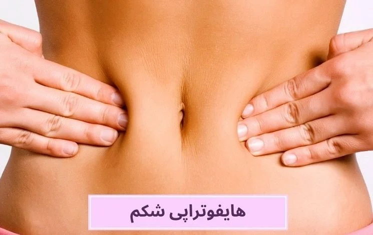 هایفوتراپی شکم