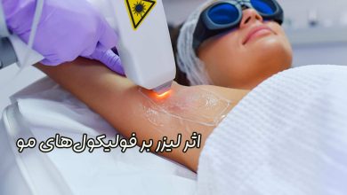 تاثیر لیزر بر فولیکول مو