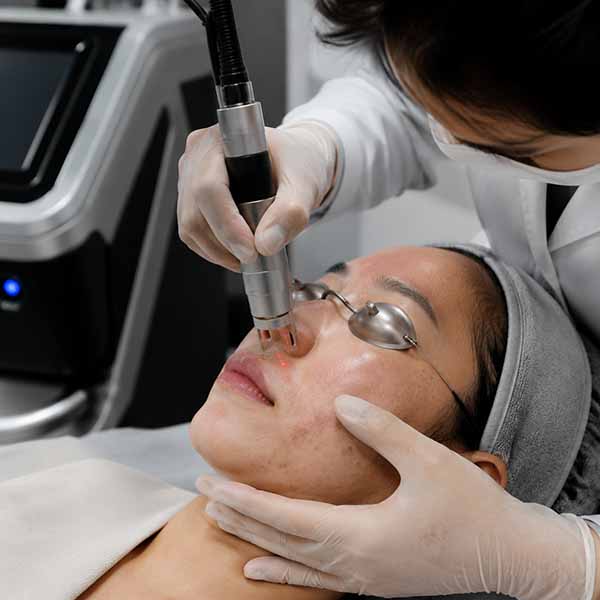 بهبود جای جوش و اسکارهای سطحی با دستگاه لیزر پیکوشور