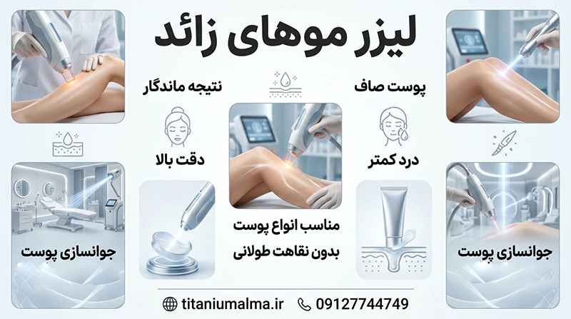 عمل لیزر موهای زائد عمل لیزر موهای زائد
